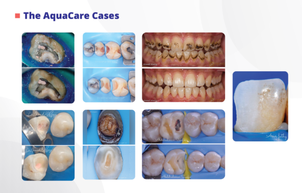 AquaCare Cases - BiBODENT